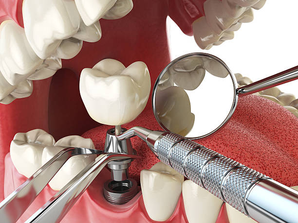 Best Weekend Emergency Dentist in Occoquan, VA